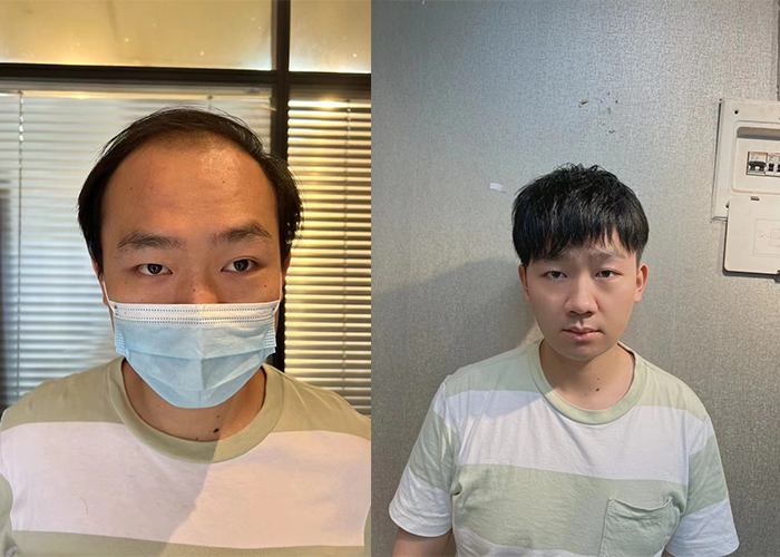 上海哪里有补发假发？（地址分享）