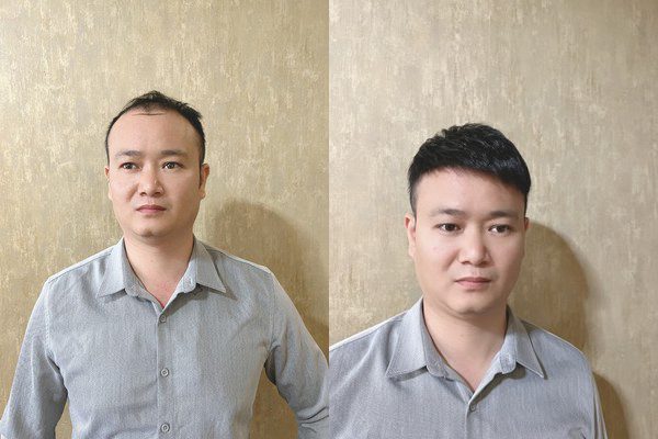 珠海高端假发定制专卖店在哪里？（地址分享）