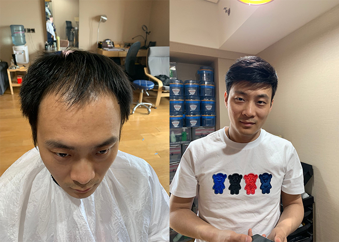 昆明什么地方有卖高端假发？