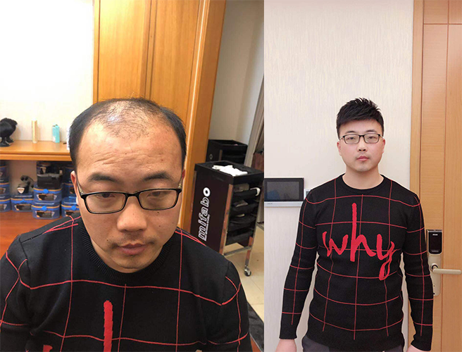 无锡假发定制哪家好？（无锡假发定制推荐）