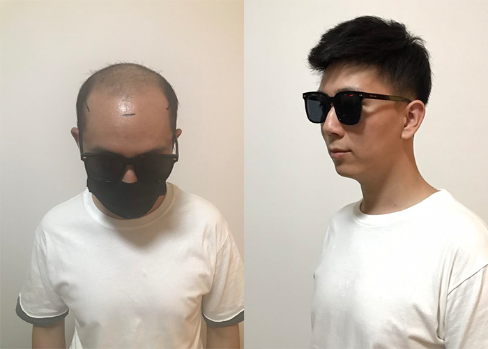 海淀区假发实体店哪里有？（北京海淀假发店推荐）