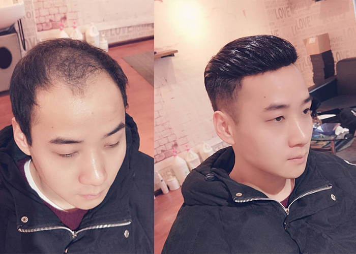 真头发做的假发专卖店深圳有没有？