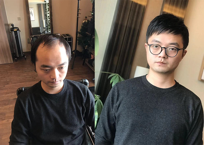 假发顺便发效果