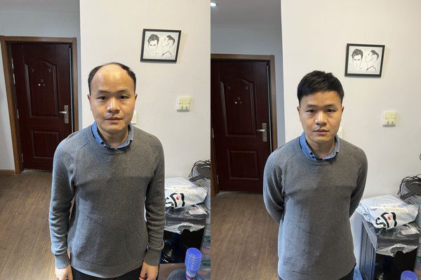 成都哪个商场有假发专卖店？（地址分享）