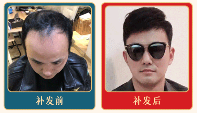 佩戴效果展示