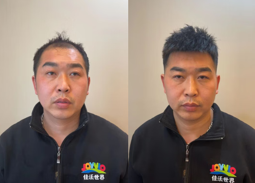 威海哪里有卖假发片的实体店？（威海假发店地址分享）