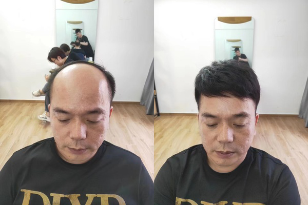 杭州男士假发套实体店在哪里？（地址分享）