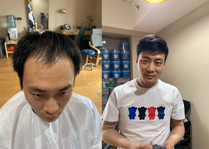 济南哪里有卖假发片的？（济南卖假发片的店地址）