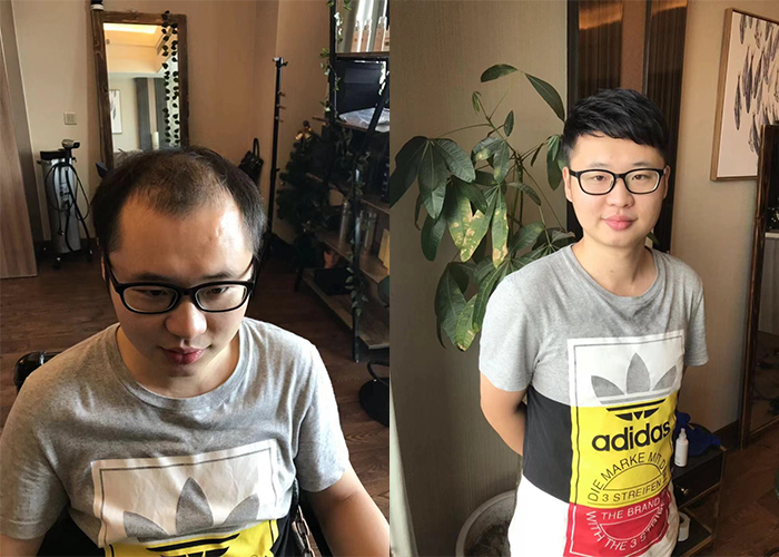 中山哪里有卖假发的实体店？（中山卖假发的实体店地址）
