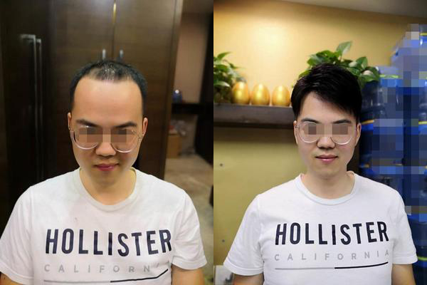 真的头发,而且效果也挺好的