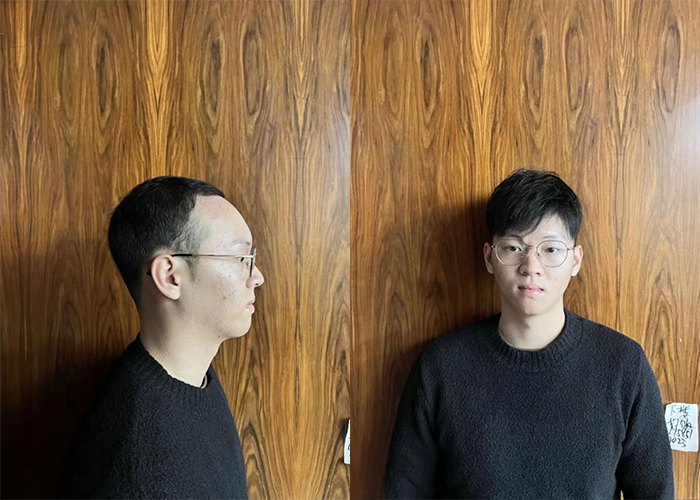 沈阳有没做假发的地方？（沈阳做假发的地址分享）