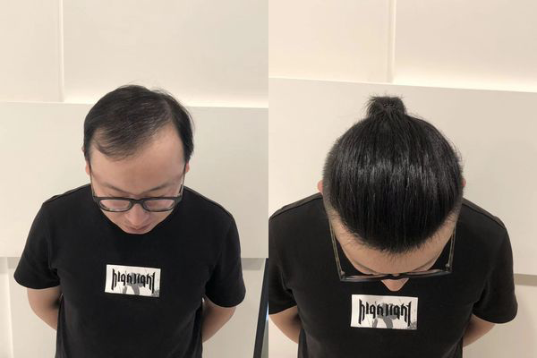 极客侠头顶假发片怎么样？（极客侠头顶假发片图片效果）