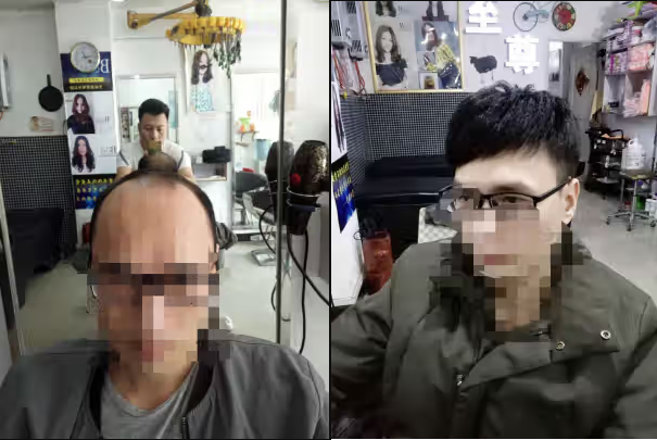 昆明哪里有卖假发的专卖店？