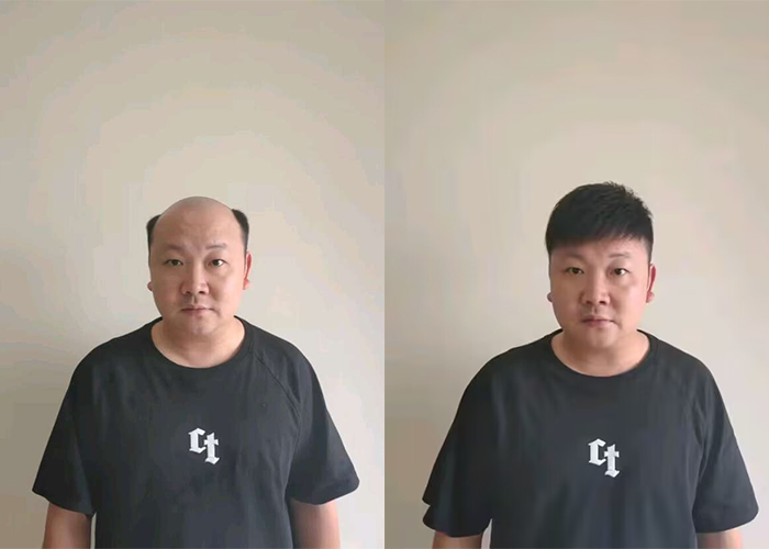 深圳哪里有定做假发的地方？（深圳定做假发地址）