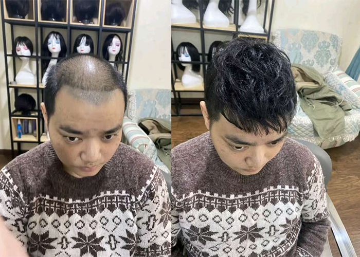 长沙有补头发的店吗？
