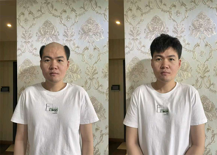 北京假发片做的最好的店是哪家？