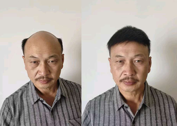 非常适合我的脸型