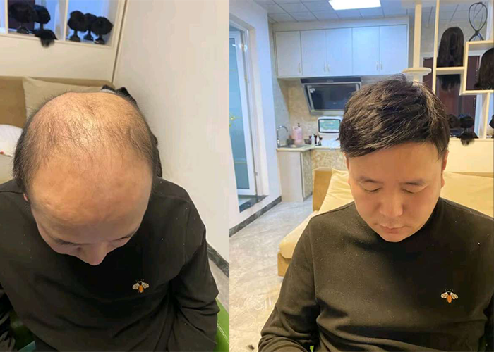 合肥哪里有卖假发的地方？（地址分享推荐）