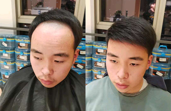 极客侠假发佩戴效果