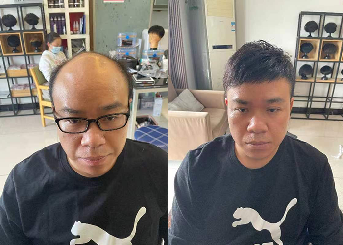 济南哪儿有老年男士假发？