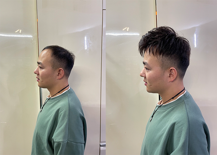 成都假发定制哪家最好