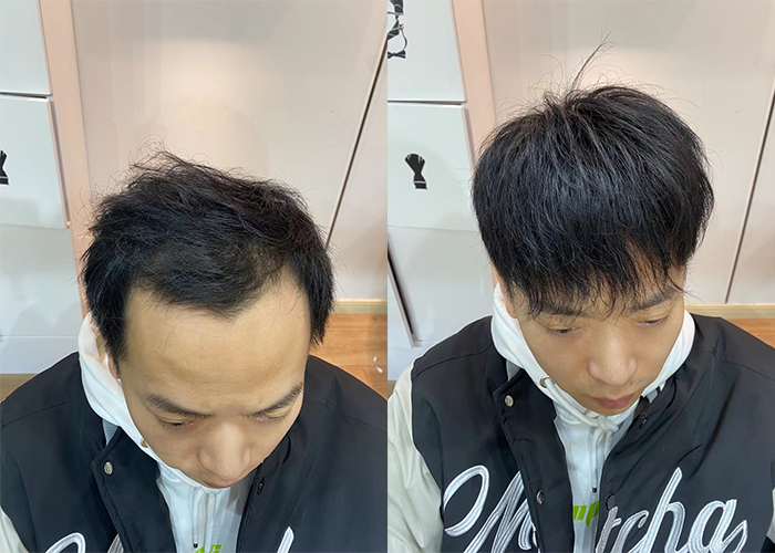 极客侠补发发际线假发好不好？（图片展示）