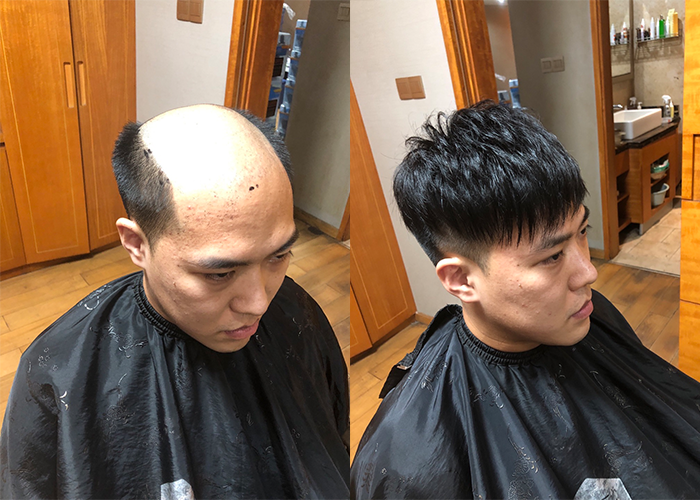 戴上之后觉得真好,年轻了至少五岁