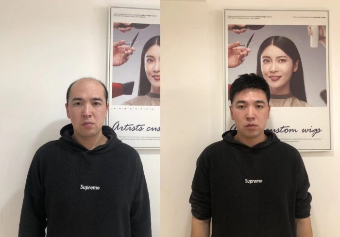 贵阳补发店哪家最好？