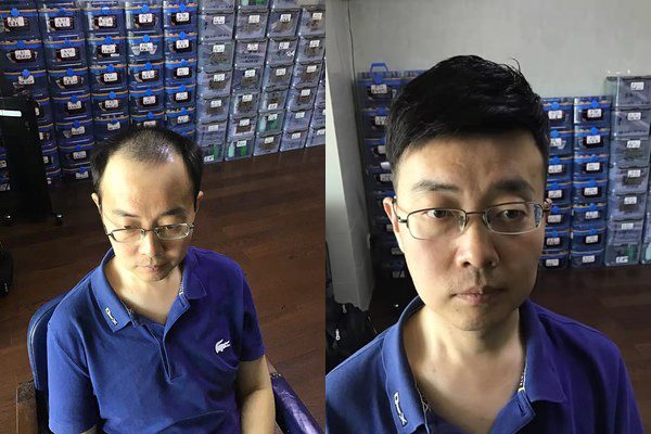 福州假发定制哪家好？