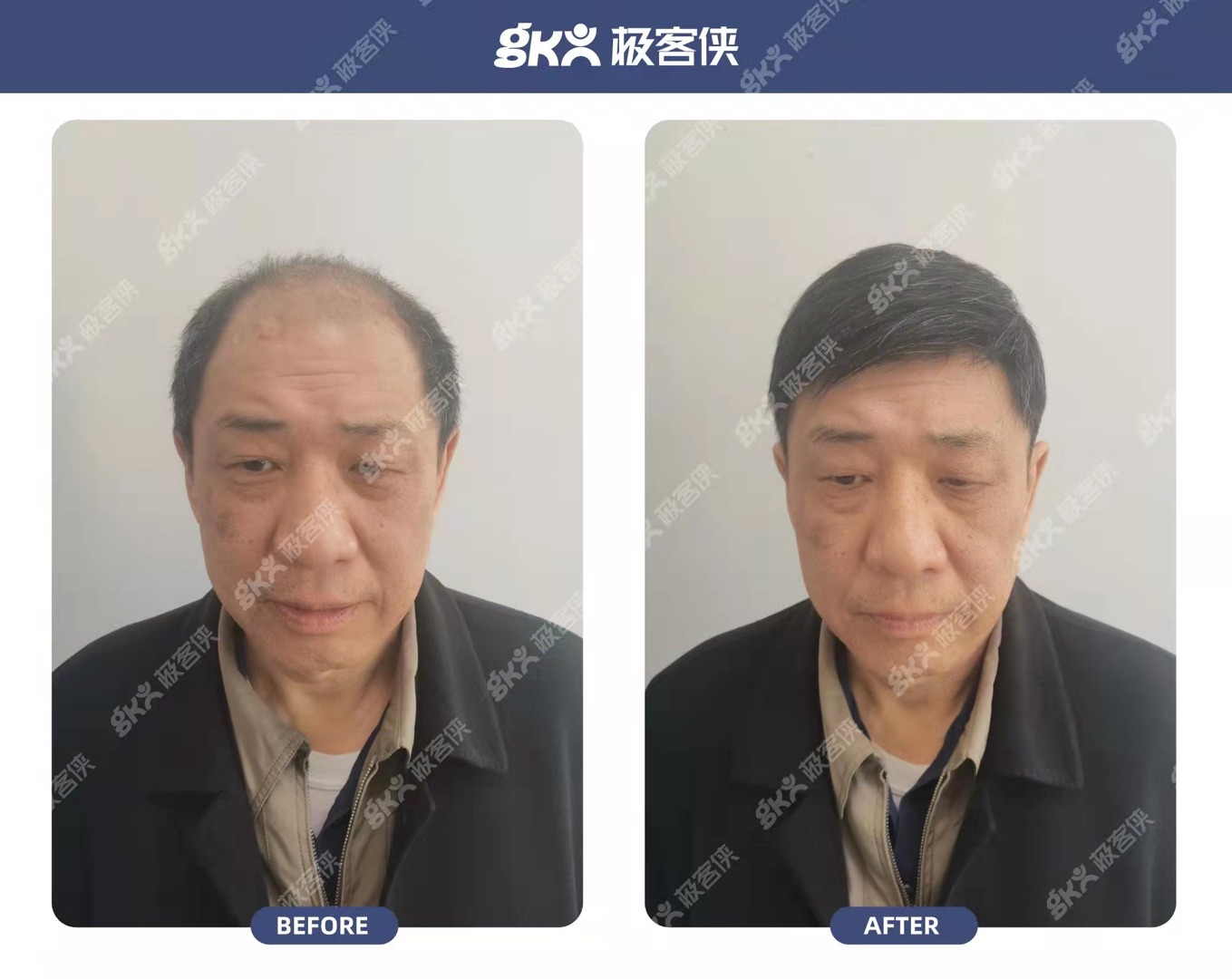 中老年男士假发佩戴效果