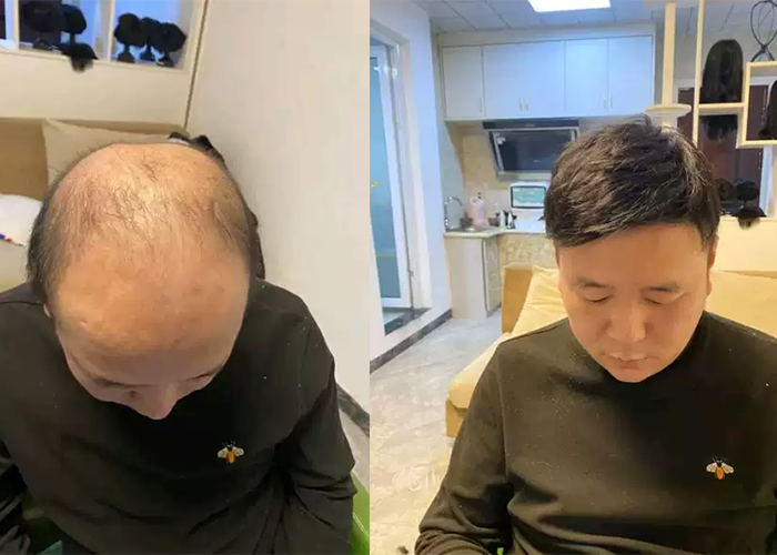 济南历下区有假发吗？（必须的）