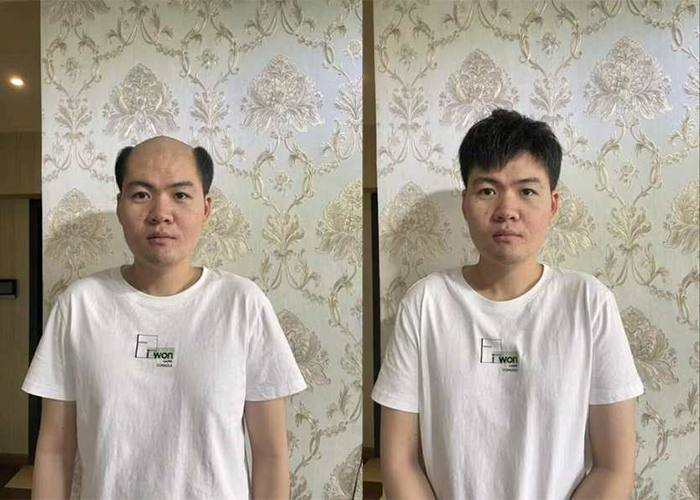 极客侠定制头顶发片效果怎么样