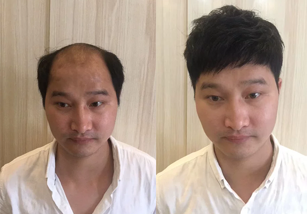 长春哪里有卖假发的地方？（长春卖假发的地方推荐）