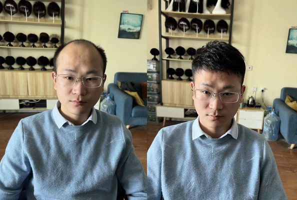 重庆假发定制哪家最好？（用过的发友这样说）