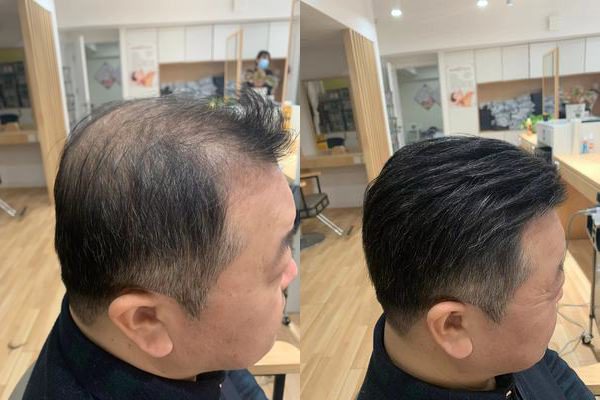 广州哪里有男士假发定制？（广州男士假发定制地址分享）