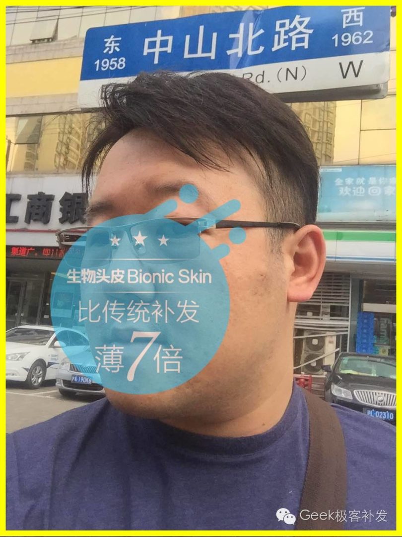 补发后效果