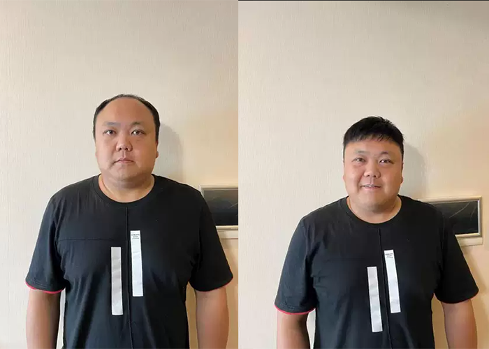 戴起来看着挺自然的,发丝也和真发比较像