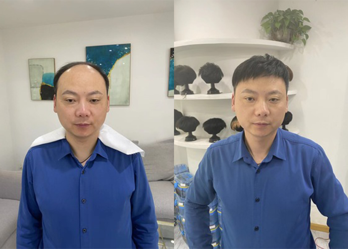假发片佩戴效果