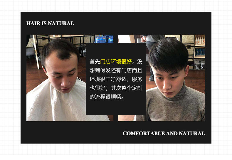 天津织发补发的哪家好？（天津织发补发推荐）