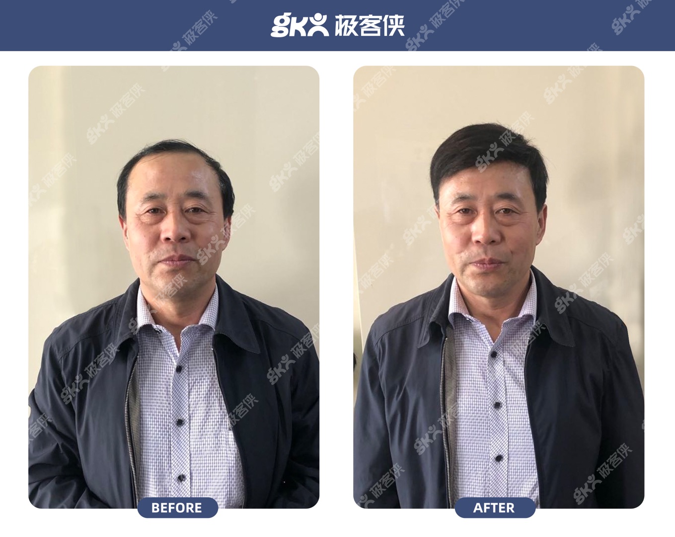 假发片遮白发效果怎么样？（效果看图）