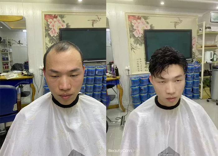 极客侠假发补发案例