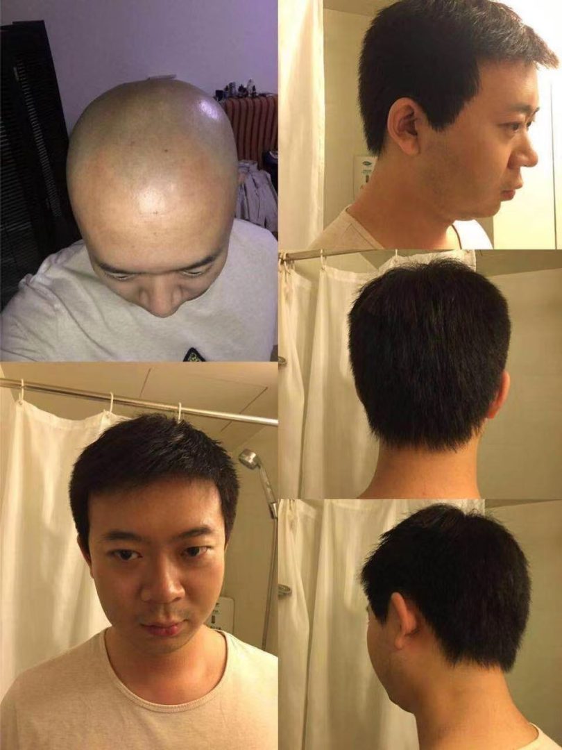 光头带假发会不会很容易看出来?