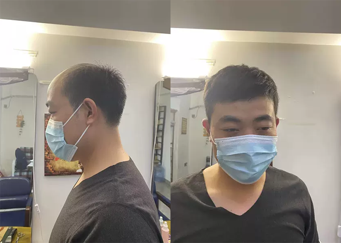 定制真头发假发哪里靠谱？（用过假发的这样说）