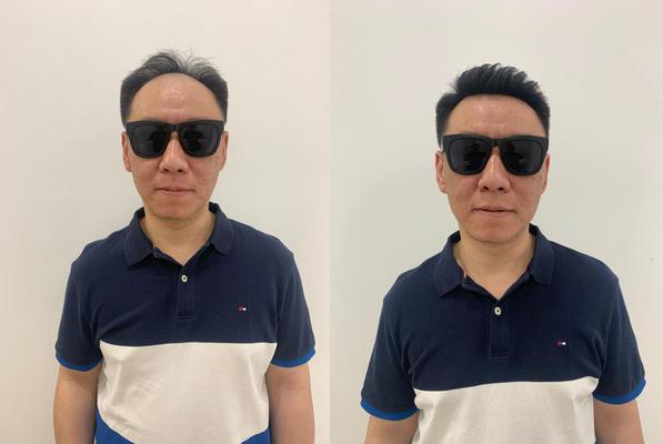 假发片佩戴效果展示