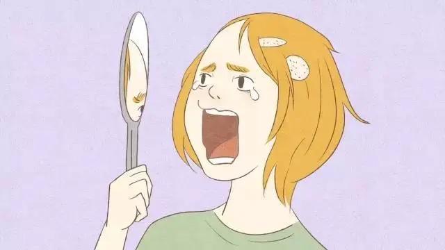 斑秃