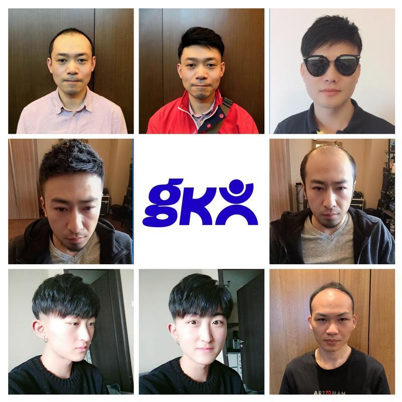 极客侠假发补发效果 极客侠假发补发效果