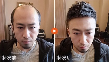 补发前后效果对比 补发前后效果对比