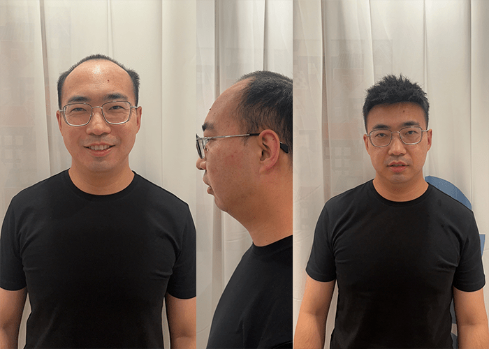 【转载】极客补发：脱发严重，戴假发坑不坑？