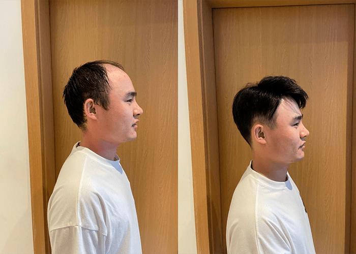 直夸我变年轻了 直夸我变年轻了