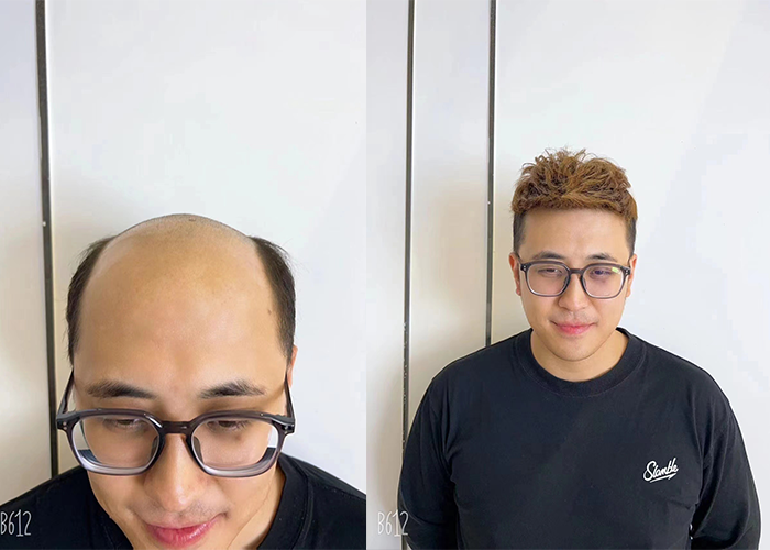 假发店哪家好？（过来人是这样评价的）